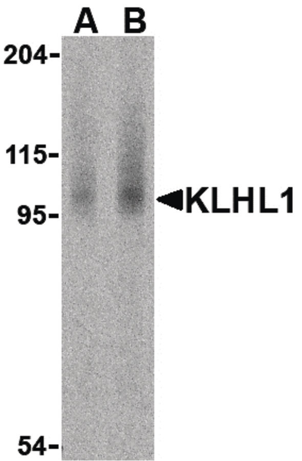 KLHL1 Antibody - Western blot of KLHL1 in human brain cell lysate with KLHL1 antibody at (A) 2 and (B) 4 ug /ml.