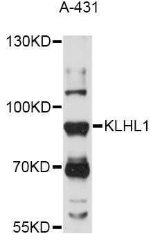 KLHL1 Antibody - Western blot analysis of extracts of A-431 cells, using KLHL1 antibody at 1:1000 dilution. The secondary antibody used was an HRP Goat Anti-Rabbit IgG (H+L) at 1:10000 dilution. Lysates were loaded 25ug per lane and 3% nonfat dry milk in TBST was used for blocking. An ECL Kit was used for detection and the exposure time was 30s.