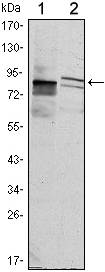 KLHL11 Antibody - Western blot using KLHL11 mouse monoclonal antibody against HeLa (1) and MCF-7 (2) cell lysate.