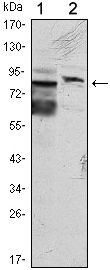 KLHL11 Antibody - KLHL11 Antibody in Western Blot (WB)