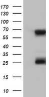 KLHL12 Antibody - HEK293T cells were transfected with the pCMV6-ENTRY control (Left lane) or pCMV6-ENTRY KLHL12 (Right lane) cDNA for 48 hrs and lysed. Equivalent amounts of cell lysates (5 ug per lane) were separated by SDS-PAGE and immunoblotted with anti-KLHL12.