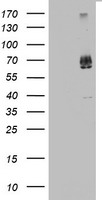 KLHL12 Antibody - HEK293T cells were transfected with the pCMV6-ENTRY control (Left lane) or pCMV6-ENTRY KLHL12 (Right lane) cDNA for 48 hrs and lysed. Equivalent amounts of cell lysates (5 ug per lane) were separated by SDS-PAGE and immunoblotted with anti-KLHL12.