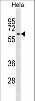 KLHL12 Antibody - KLHL12 Antibody western blot of HeLa cell line lysates (35 ug/lane). The KLHL12 antibody detected the KLHL12 protein (arrow).