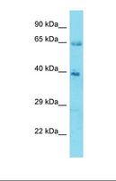 KLHL12 Antibody - Western blot of Human Stomach Tumor. KLHL12 antibody dilution 1.0 ug/ml.  This image was taken for the unconjugated form of this product. Other forms have not been tested.