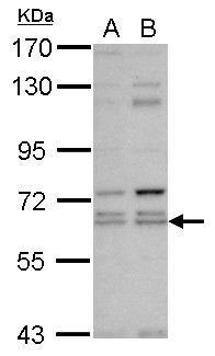 KLHL12 Antibody - Sample (30 ug of whole cell lysate) A: NT2D1 B: IMR32 7.5% SDS PAGE C3IP1 antibody diluted at 1:1000