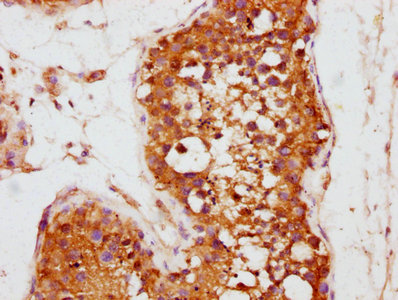 KLHL12 Antibody - IHC image of KLHL12 Antibody diluted at 1:800 and staining in paraffin-embedded human testis tissue performed on a Leica BondTM system. After dewaxing and hydration, antigen retrieval was mediated by high pressure in a citrate buffer (pH 6.0). Section was blocked with 10% normal goat serum 30min at RT. Then primary antibody (1% BSA) was incubated at 4°C overnight. The primary is detected by a biotinylated secondary antibody and visualized using an HRP conjugated SP system.