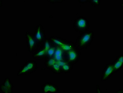 KLHL12 Antibody - Immunofluorescence staining of PC-3 cells with KLHL12 Antibody at 1:133, counter-stained with DAPI. The cells were fixed in 4% formaldehyde, permeabilized using 0.2% Triton X-100 and blocked in 10% normal Goat Serum. The cells were then incubated with the antibody overnight at 4°C. The secondary antibody was Alexa Fluor 488-congugated AffiniPure Goat Anti-Rabbit IgG(H+L).