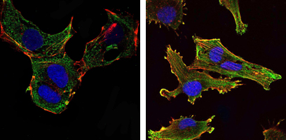KLHL13 Antibody - Immunofluorescence of NTERA-2 cells (left) and U251 (right) cells using KLHL13 mouse monoclonal antibody (green). Blue: DRAQ5 fluorescent DNA dye. Red: Actin filaments have been labeled with Alexa Fluor-555 phalloidin.