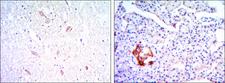 KLHL13 Antibody - IHC of paraffin-embedded brain tissues (left) and pancreas tissues (right) using KLHL13 mouse monoclonal antibody with DAB staining.