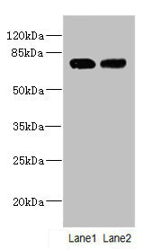 KLHL13 Antibody - Western blot All Lanes: KLHL13 antibody at 5.06ug/ml Lane 1: Jurkat whole cell lysate Lane 2: Hela whole cell lysate Secondary Goat polyclonal to rabbit IgG at 1/10000 dilution Predicted band size: 74,70,73,75 kDa Observed band size: 74 kDa