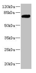 KLHL13 Antibody - Western blot All lanes: KLHL13 antibody at 5.06µg/ml + Jurkat whole cell lysate Secondary Goat polyclonal to rabbit IgG at 1/10000 dilution Predicted band size: 74, 70, 73, 75 kDa Observed band size: 74 kDa