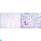 KLHL13 Antibody - Immunohistochemistry (IHC) analysis of paraffin-embedded brain tissues (left) and pancreas tissues (right) with DAB staining using KLHL13 Monoclonal Antibody.