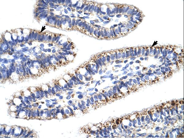 KLHL13 Antibody - KLHL13 antibody ARP34652_P050-NP_277030-KLHL13 (kelch-like 13 (Drosophila)) Antibody was used in IHC to stain formalin-fixed, paraffin-embedded human intestine.  This image was taken for the unconjugated form of this product. Other forms have not been tested.