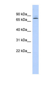 KLHL14 Antibody - KLHL14 antibody Western blot of Fetal Kidney lysate. This image was taken for the unconjugated form of this product. Other forms have not been tested.