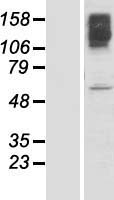 KLHL15 Protein - Western validation with an anti-DDK antibody * L: Control HEK293 lysate R: Over-expression lysate