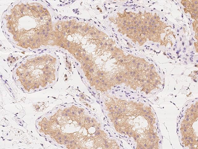 KLHL17 Antibody - Immunochemical staining of human KLHL17 in human testis with rabbit polyclonal antibody at 1:1000 dilution, formalin-fixed paraffin embedded sections.
