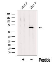 KLHL18 Antibody - Western blot analysis of extracts of HeLa cells using KLHL18 antibody. The lane on the left was treated with blocking peptide.