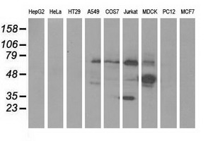 KLHL2 / MAV Antibody - Western blot of extracts (35 ug) from 9 different cell lines by using anti-KLHL2 monoclonal antibody.