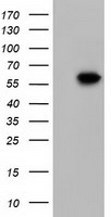 KLHL2 / MAV Antibody - HEK293T cells were transfected with the pCMV6-ENTRY control (Left lane) or pCMV6-ENTRY KLHL2 (Right lane) cDNA for 48 hrs and lysed. Equivalent amounts of cell lysates (5 ug per lane) were separated by SDS-PAGE and immunoblotted with anti-KLHL2.
