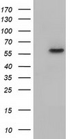 KLHL2 / MAV Antibody - HEK293T cells were transfected with the pCMV6-ENTRY control (Left lane) or pCMV6-ENTRY KLHL2 (Right lane) cDNA for 48 hrs and lysed. Equivalent amounts of cell lysates (5 ug per lane) were separated by SDS-PAGE and immunoblotted with anti-KLHL2.
