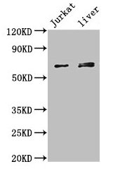 KLHL2 / MAV Antibody - Western Blot Positive WB detected in: MCF-7 whole cell lysate, Jurkat whole cell lysate, HEK293 whole cell lysate, Rat brain tissue, Mouse heart tissue, Mouse liver tissue, Mouse brain tissue All lanes: KLHL2 antibody at 3µg/ml Secondary Goat polyclonal to rabbit IgG at 1/50000 dilution Predicted band size: 66, 67, 57 kDa Observed band size: 66, 67 kDa