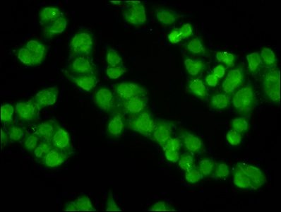 KLHL20 Antibody - Immunofluorescence staining of Hela cells diluted at 1:100, counter-stained with DAPI. The cells were fixed in 4% formaldehyde, permeabilized using 0.2% Triton X-100 and blocked in 10% normal Goat Serum. The cells were then incubated with the antibody overnight at 4°C.The Secondary antibody was Alexa Fluor 488-congugated AffiniPure Goat Anti-Rabbit IgG (H+L).
