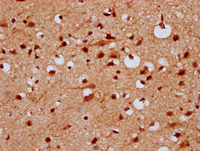KLHL20 Antibody - Immunohistochemistry Dilution at 1:300 and staining in paraffin-embedded human brain tissue performed on a Leica BondTM system. After dewaxing and hydration, antigen retrieval was mediated by high pressure in a citrate buffer (pH 6.0). Section was blocked with 10% normal Goat serum 30min at RT. Then primary antibody (1% BSA) was incubated at 4°C overnight. The primary is detected by a biotinylated Secondary antibody and visualized using an HRP conjugated SP system.