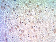 KLHL21 Antibody - IHC of paraffin-embedded human brain tissues using KLHL21 mouse monoclonal antibody with DAB staining.