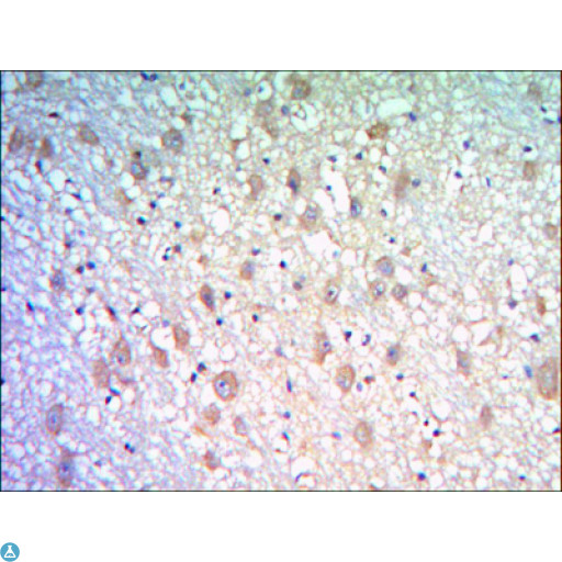 KLHL21 Antibody - Immunohistochemistry (IHC) analysis of paraffin-embedded Human Brain tissues with DAB staining using KLHL21 Monoclonal Antibody.
