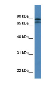 KLHL22 Antibody - KLHL22 antibody Western blot of Jurkat lysate.  This image was taken for the unconjugated form of this product. Other forms have not been tested.