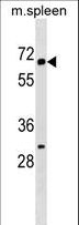 KLHL22 Antibody - KLH22 Antibody western blot of mouse spleen tissue lysates (35 ug/lane). The KLH22 antibody detected the KLH22 protein (arrow).