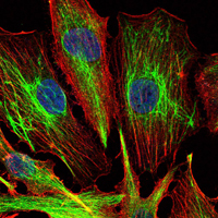KLHL22 Antibody - Immunofluorescence of U251 cells using KLHL22 mouse monoclonal antibody (green). Blue: DRAQ5 fluorescent DNA dye. Red: Actin filaments have been labeled with Alexa Fluor-555 phalloidin.