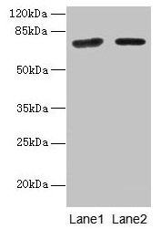 KLHL22 Antibody - Western blot All lanes: KLHL22 antibody at 8µg/ml Lane 1: Jurkat whole cell lysate Lane 2: NIH/3T3 whole cell lysate Secondary Goat polyclonal to rabbit IgG at 1/10000 dilution Predicted band size: 72, 56 kDa Observed band size: 72 kDa
