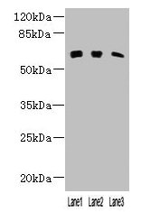 KLHL23 Antibody - Western blot All lanes: OXNAD1 antibody at 3µg/ml Lane 1: Mouse lung tissue Lane 2: Mouse kidney tissue Lane 3: Human placenta tissue Lane 4: HL60 whole cell lysate Secondary Goat polyclonal to rabbit IgG at 1/10000 dilution Predicted band size: 64 kDa Observed band size: 64 kDa