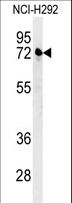KLHL24 Antibody - KLHL24 Antibody western blot of NCI-H292 cell line lysates (35 ug/lane). The KLHL24 antibody detected the KLHL24 protein (arrow).
