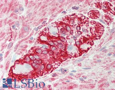 KLHL25 Antibody - Human Colon, Myenteric plexus: Formalin-Fixed, Paraffin-Embedded (FFPE).  This image was taken for the unconjugated form of this product. Other forms have not been tested.