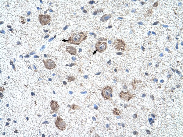 KLHL25 Antibody - KLHL25 antibody ARP34609_T100-NP_071925-KLHL25(kelch-like 25 (Drosophila)) Antibody was used in IHC to stain formalin-fixed, paraffin-embedded human brain.  This image was taken for the unconjugated form of this product. Other forms have not been tested.