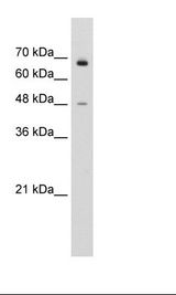 KLHL25 Antibody - Jurkat Cell Lysate.  This image was taken for the unconjugated form of this product. Other forms have not been tested.