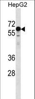 KLHL25 Antibody - KLHL25 Antibody western blot of HepG2 cell line lysates (35 ug/lane). The KLHL25 antibody detected the KLHL25 protein (arrow).