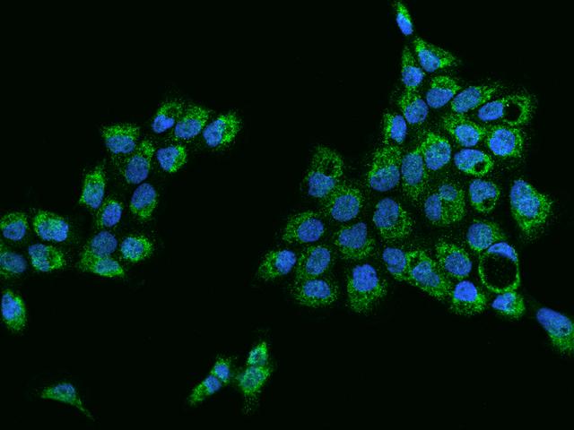 KLHL25 Antibody - Immunofluorescence staining of KLHL25 in A431 cells. Cells were fixed with 4% PFA, permeabilzed with 0.1% Triton X-100 in PBS, blocked with 10% serum, and incubated with rabbit anti-Human KLHL25 polyclonal antibody (dilution ratio 1:200) at 4°C overnight. Then cells were stained with the Alexa Fluor 488-conjugated Goat Anti-rabbit IgG secondary antibody (green) and counterstained with DAPI (blue). Positive staining was localized to Cytoplasm.