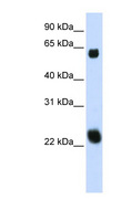 KLHL26 Antibody - KLHL26 antibody Western blot of 293T cell lysate. This image was taken for the unconjugated form of this product. Other forms have not been tested.