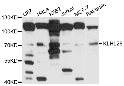 KLHL26 Antibody - Western blot analysis of extracts of various cell lines, using KLHL26 antibody at 1:1000 dilution. The secondary antibody used was an HRP Goat Anti-Rabbit IgG (H+L) at 1:10000 dilution. Lysates were loaded 25ug per lane and 3% nonfat dry milk in TBST was used for blocking. An ECL Kit was used for detection and the exposure time was 10s.