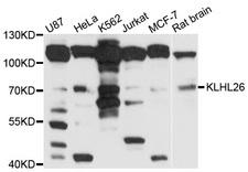 KLHL26 Antibody - Western blot analysis of extracts of various cell lines, using KLHL26 antibody at 1:1000 dilution. The secondary antibody used was an HRP Goat Anti-Rabbit IgG (H+L) at 1:10000 dilution. Lysates were loaded 25ug per lane and 3% nonfat dry milk in TBST was used for blocking. An ECL Kit was used for detection and the exposure time was 10s.