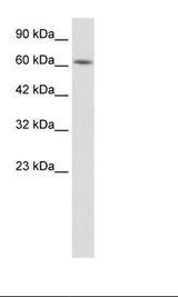 KLHL28 / BTBD5 Antibody - HepG2 Cell Lysate.  This image was taken for the unconjugated form of this product. Other forms have not been tested.