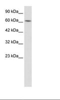 KLHL28 / BTBD5 Antibody - HepG2 Cell Lysate.  This image was taken for the unconjugated form of this product. Other forms have not been tested.