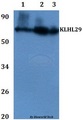 KLHL29 Antibody - Western blot of KLHL29 antibody at 1:500 dilution Line1:HEK293T whole cell lysate Line2:PC12 whole cell lysate Line3:sp20 whole cell lysate.