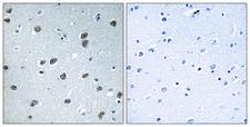 KLHL29 Antibody - Peptide - + Immunohistochemistry analysis of paraffin-embedded human brain tissue using KLHL29 antibody.