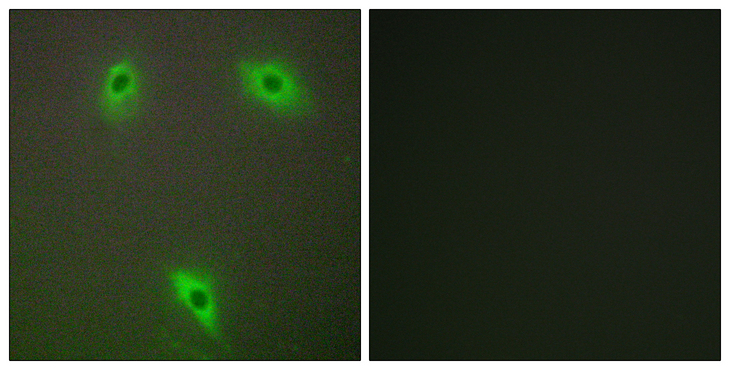 KLHL3 Antibody - Immunofluorescence analysis of A549 cells, using KLHL3 Antibody. The picture on the right is blocked with the synthesized peptide.