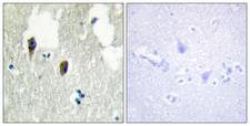 KLHL3 Antibody - Immunohistochemistry analysis of paraffin-embedded human brain tissue, using KLHL3 Antibody. The picture on the right is blocked with the synthesized peptide.