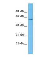 KLHL3 Antibody - Western blot of Human Breast Tumor. KLHL3 antibody dilution 1.0 ug/ml.  This image was taken for the unconjugated form of this product. Other forms have not been tested.